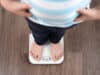 Widening inequalities are fuelling childhood obesity