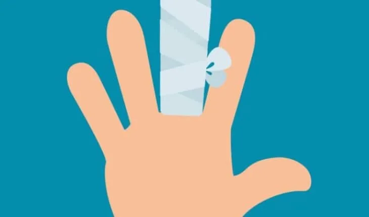 fingers