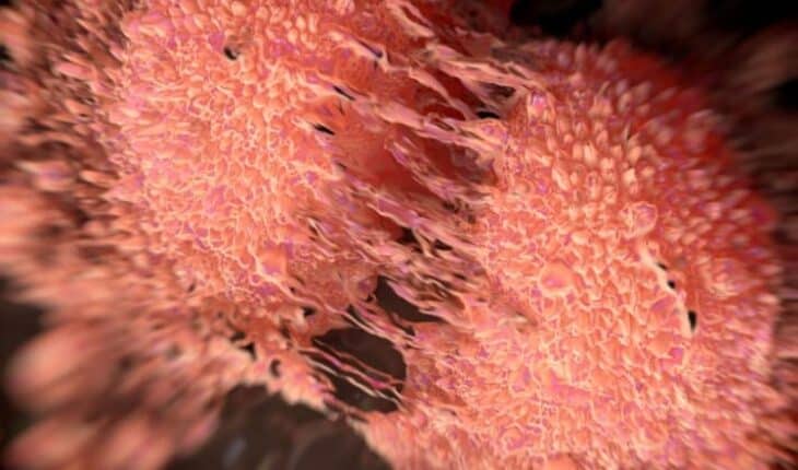 drug-resistant prostate cancer