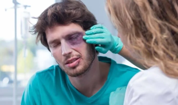 injuries