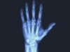 Bioengineering breakthrough could improve bone regeneration treatments