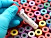 Earlier measles vaccine could help curb global outbreak