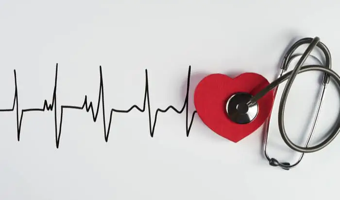Identify patients with Atrial Fibrillation