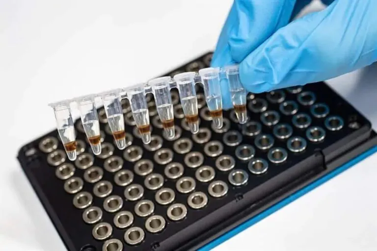 Early blood serum profile changes can identify alcohol dependence