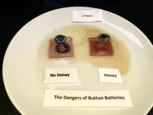 Button batteries can burn