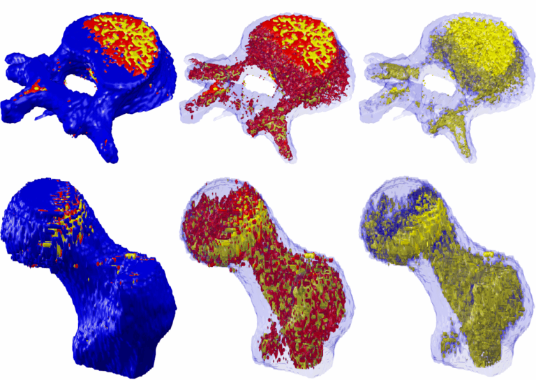 Using fat to diagnose musculoskeletal disease