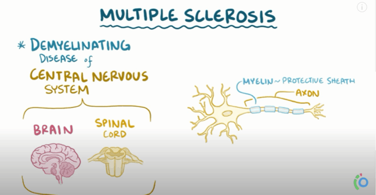Multiple sclerosis – causes, symptoms, diagnosis, treatment, pathology