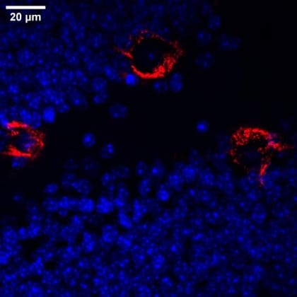 Non-invasive potential treatment for Alzheimer’s disease