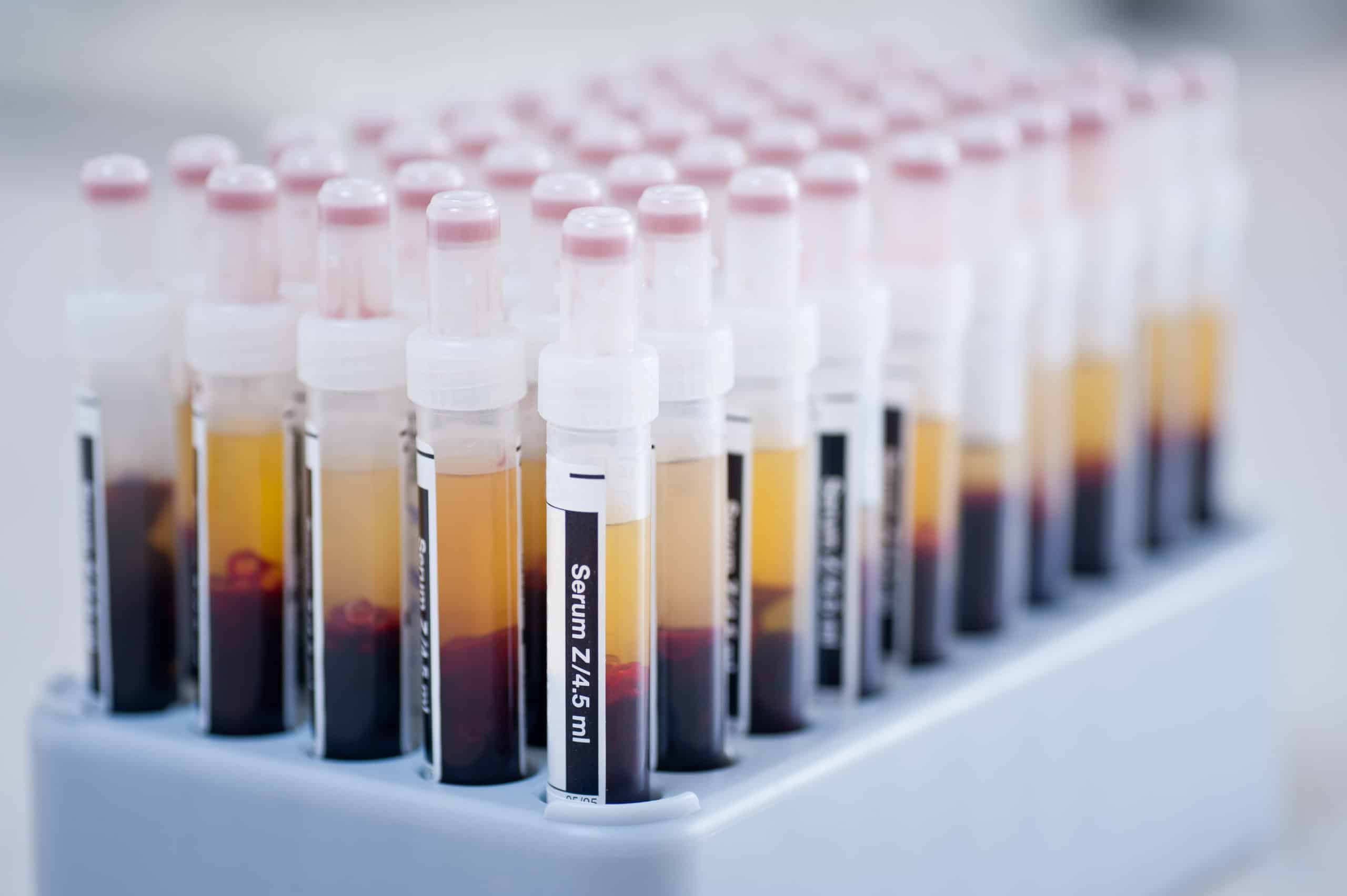 UK biobank boosts COVID-19 sample availability