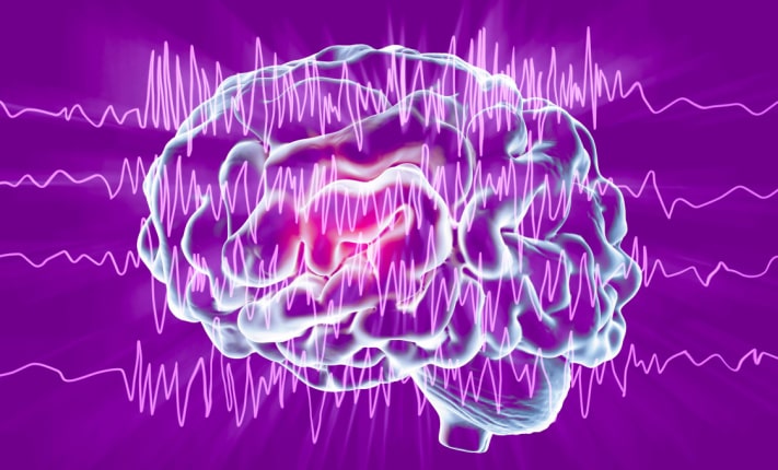 New insights on why epilepsy develops