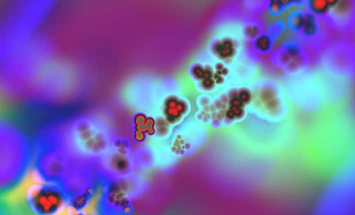 Nanoparticles deliver brain cancer treatment