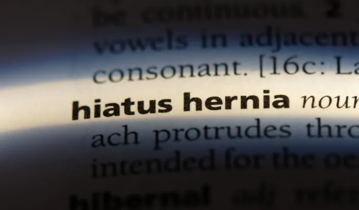 Hiatus hernia: The deadly killer that most in the UK have never heard of hiatus