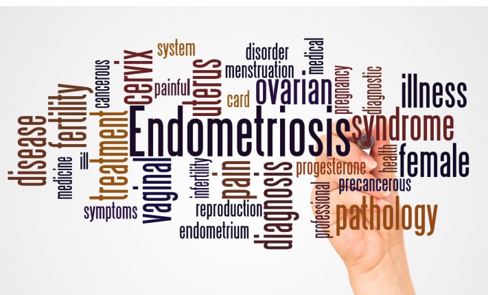 Women wait for endometriosis diagnosis with multiple symptoms endometriosis diagnosis