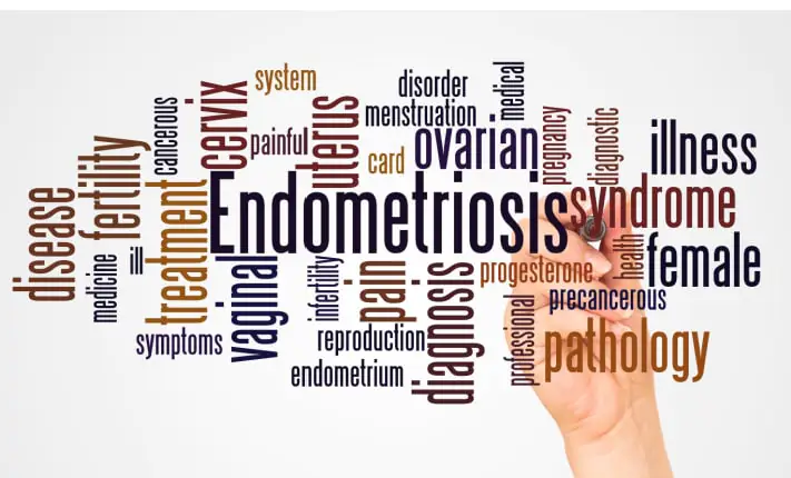 Women wait for endometriosis diagnosis with multiple symptoms endometriosis diagnosis