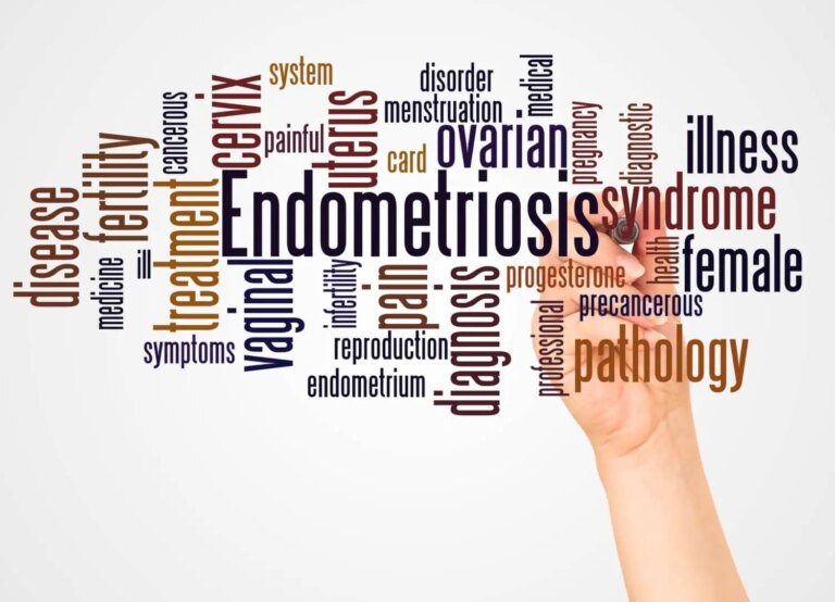 Endometriosis poses substantial burden on Australia’s health system
