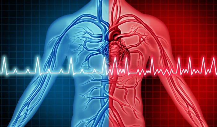 Researchers develop new tool to reduce stroke risk