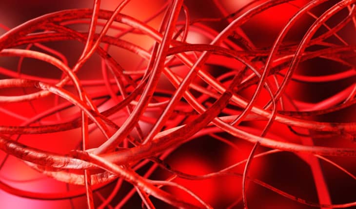 New atherosclerosis progression research