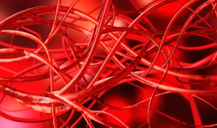 New atherosclerosis progression research atherosclerosis progression