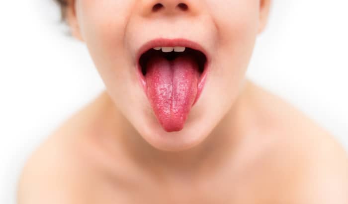 Streptococcal infections