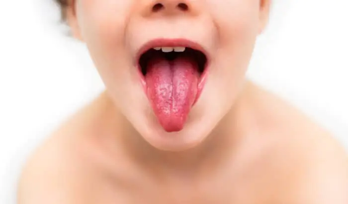 Streptococcal infections infections