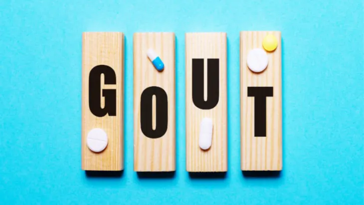 Flare-ups of gout linked to heart attack and stroke Flare-ups