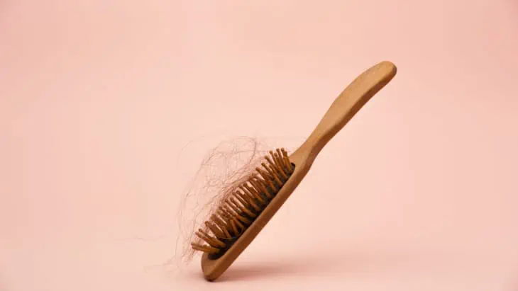 Hair loss support in 2023