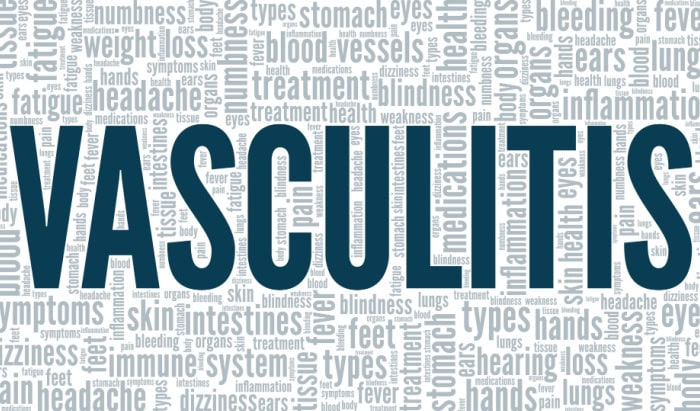Vasculitis: How to improve health outcomes and experiences of care