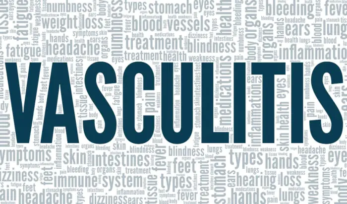 Vasculitis: How to improve health outcomes and experiences of care