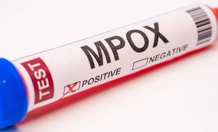 Preventing an mpox resurgence this summer
