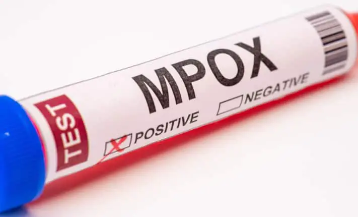 Preventing an mpox resurgence this summer