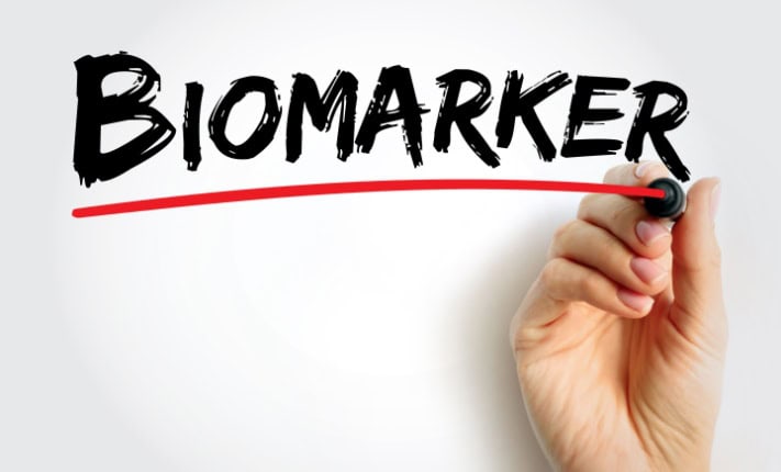 Gastric cancer: Biomarkers identified to predict the risk of relapse