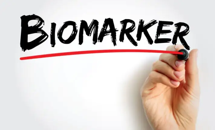 Gastric cancer: Biomarkers identified to predict the risk of relapse