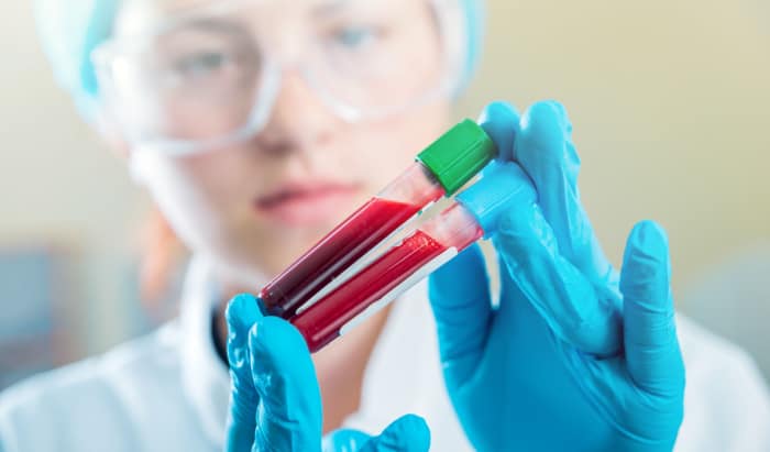 New treatment hope for chronic myeloid leukaemia