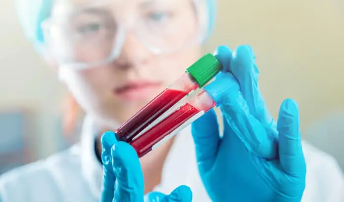 New treatment hope for chronic myeloid leukaemia