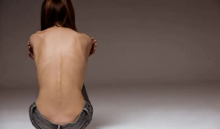 Everything you need to know about Eating Disorders disorders