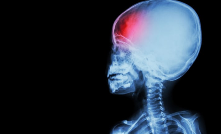 Advanced imaging predicts the recovery of children with brain injury