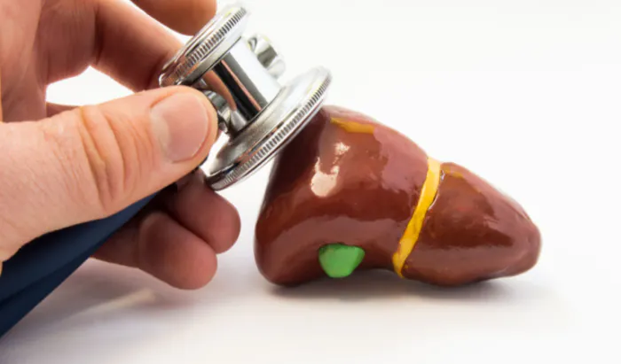 Patients at high risk of liver failure and bile duct damage liver
