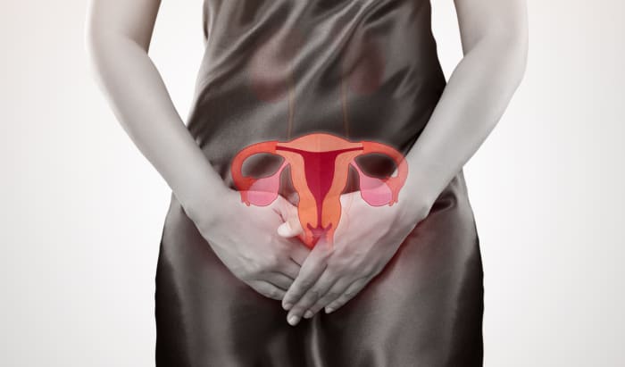 Locally advanced cervical cancer: Better odds using personalized brachytherapy