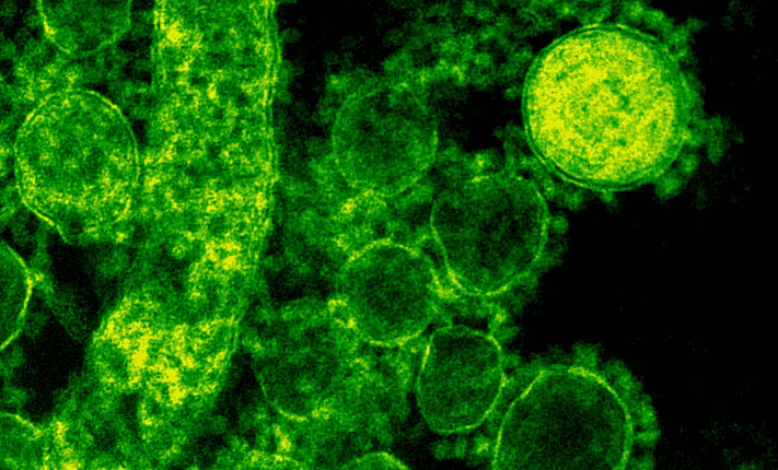 New Tool Can Detect Fast-Spreading SARS-CoV-2 Variants Early SARS-CoV-2