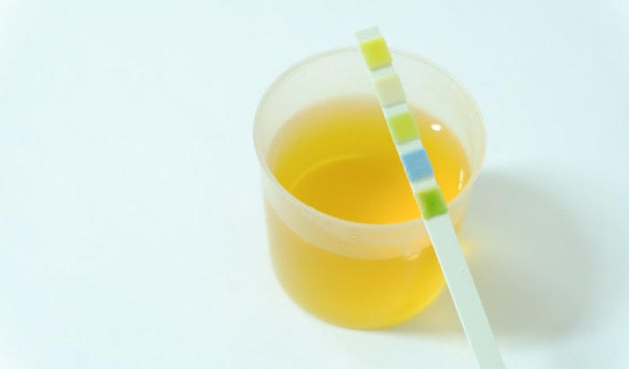 All about cystitis