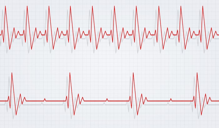 Heart Rhythm Congress in 12th year