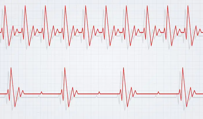 Heart Rhythm Congress in 12th year
