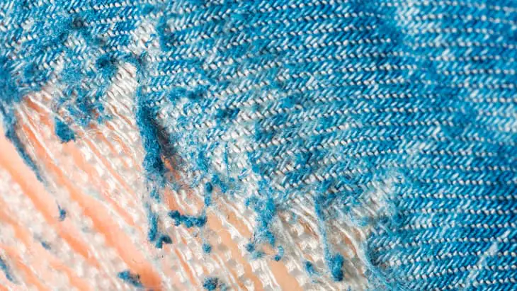 Reassuring AMD patients The Hippocratic Post - AMD