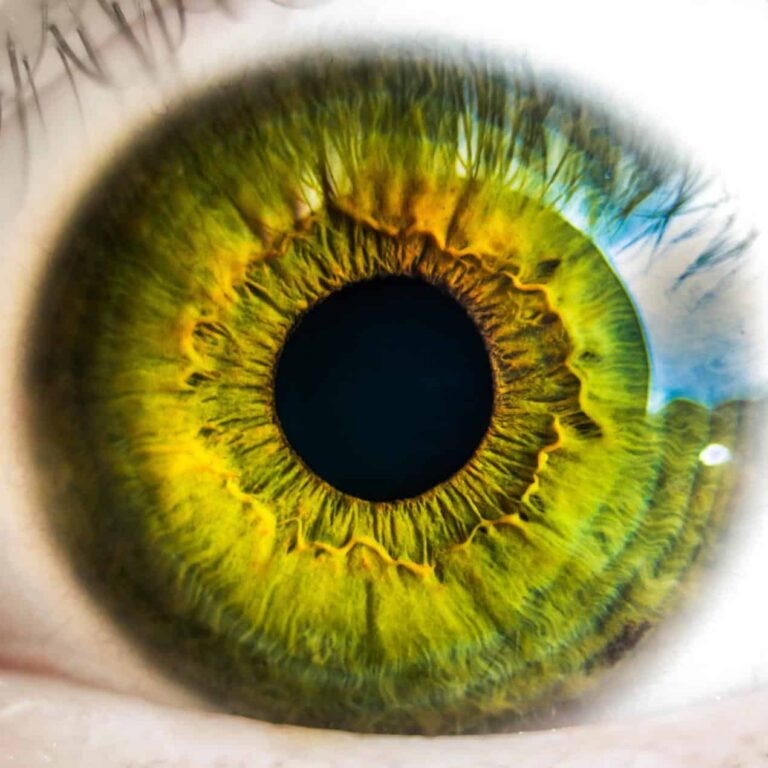 Clinical trial offers more than a glimpse into eye treatments