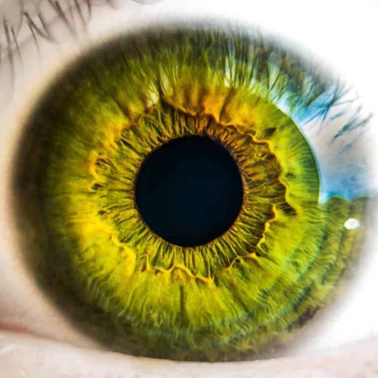 Clinical trial offers more than a glimpse into eye treatments