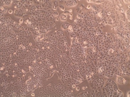 Innovative multiple-organ devices for brain diseases