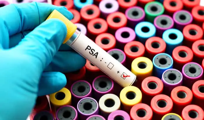 Prostate cancer: immunotherapy offers hope
