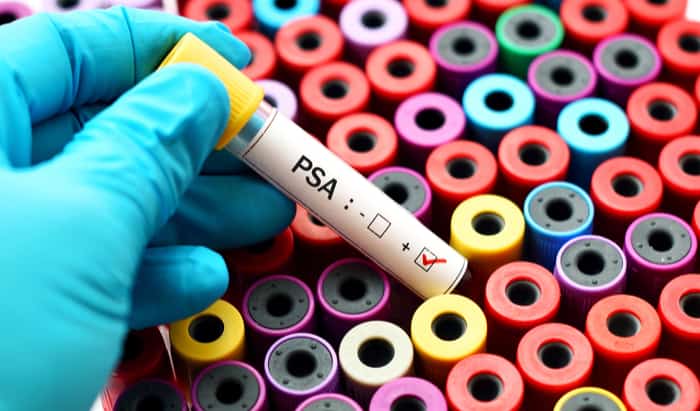 Prostate cancer treatment under pressure