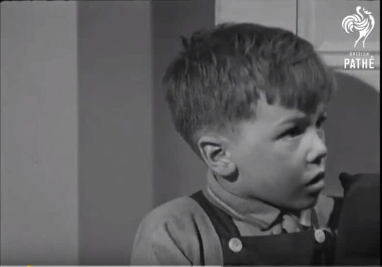 Scalds and burns in 1947