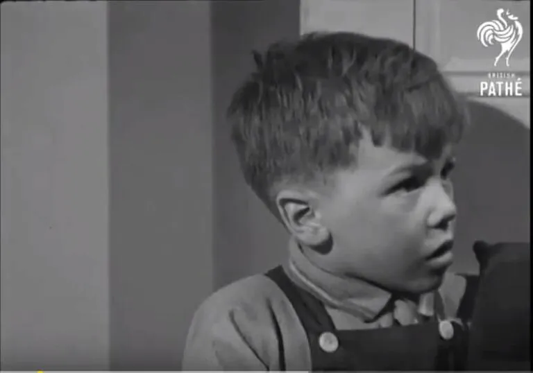 Scalds and burns in 1947